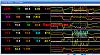 SLP DD TVS2300 issue and resolve-2-3-boost-issue.jpg