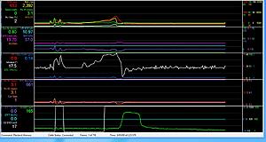 Any tuners want to check out my HP Tuners File?-pyfynxk.jpg